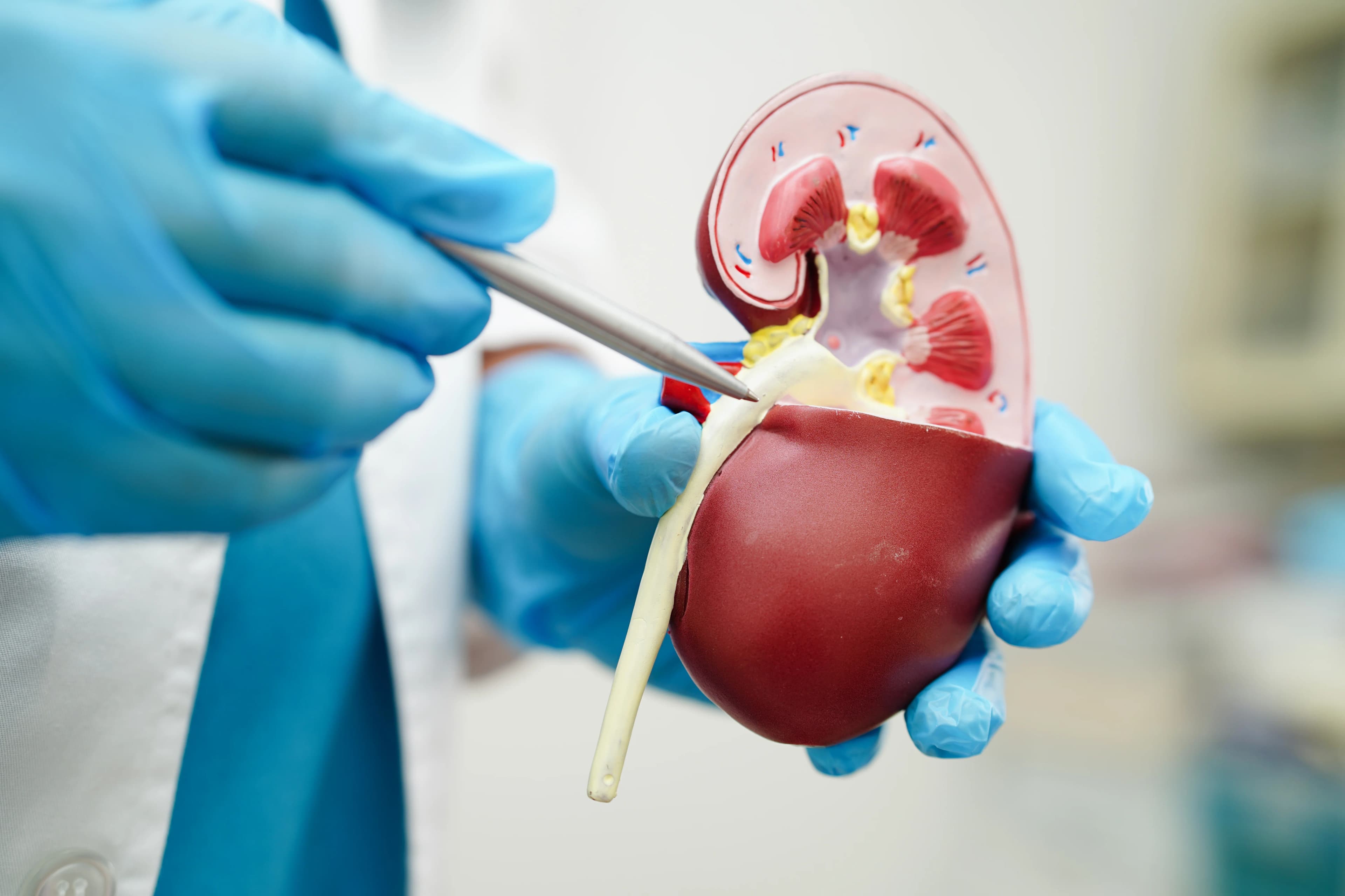 Renal Transplant